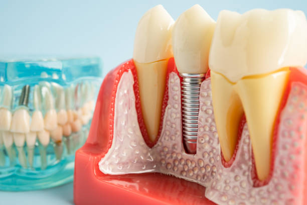 Professional Dental Services in Carnesville, GA